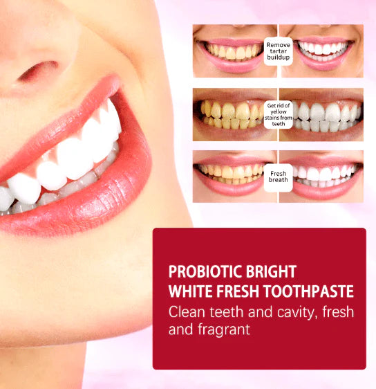 Sp-4 Toothpaste - FREE SHIPPING